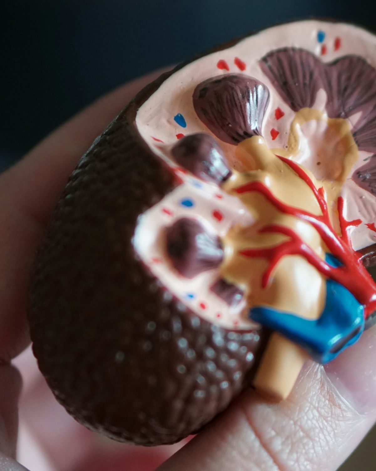 Modello anatomico di un rene in sezione tenuto in mano