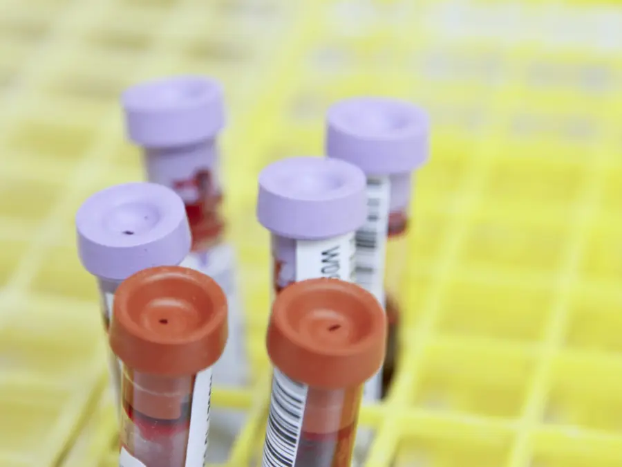 Provette per le analisi del sangue